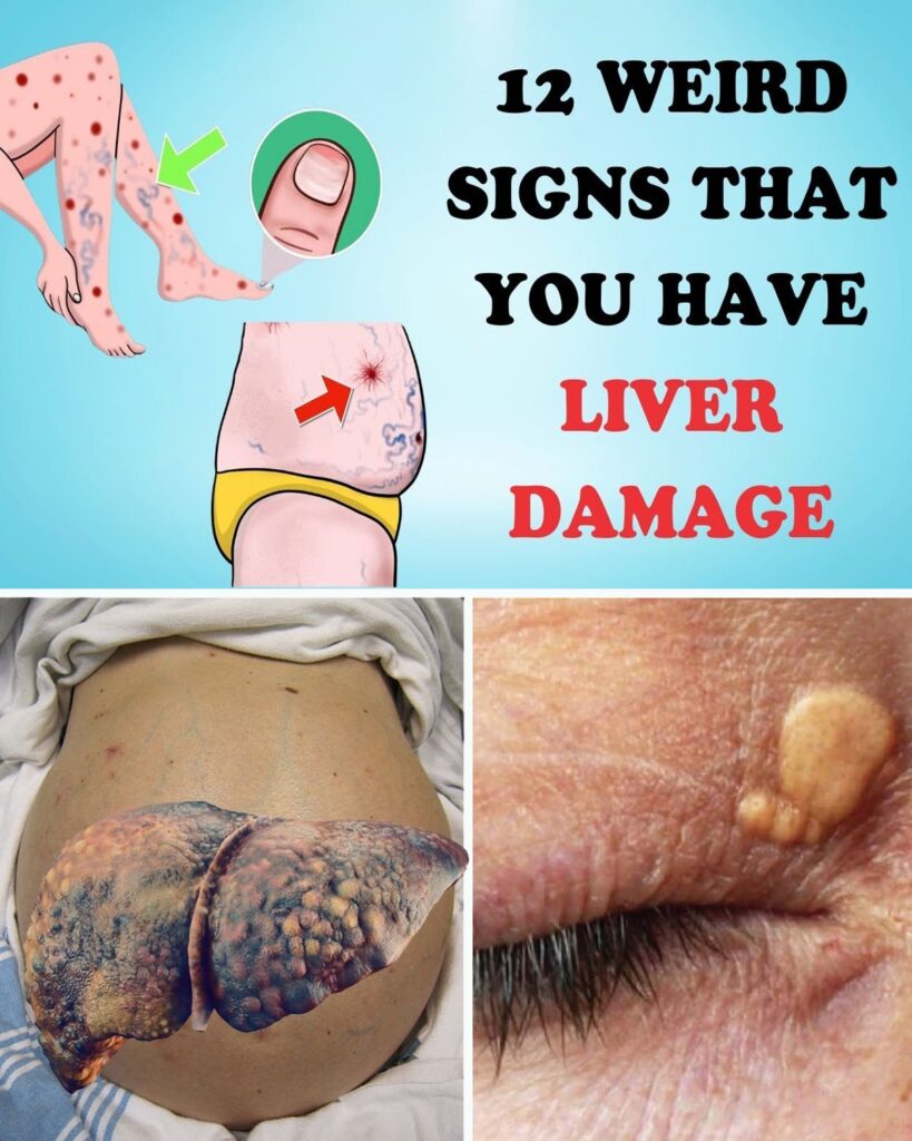 Warning: 12 Weird Signs That Could Mean Your Liver Is Struggling