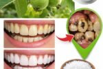 🌿 Discover Nature’s Secret: 3 Powerful Guava Leaf Remedies to Support Tooth Health