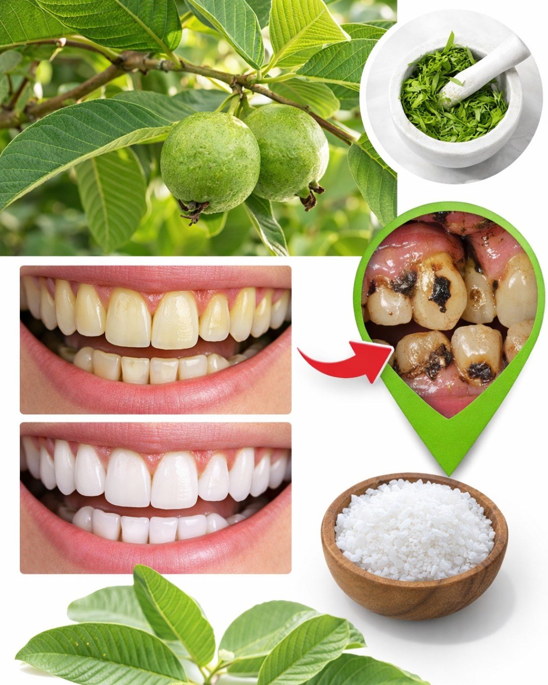 🌿 Discover Nature’s Secret: 3 Powerful Guava Leaf Remedies to Support Tooth Health