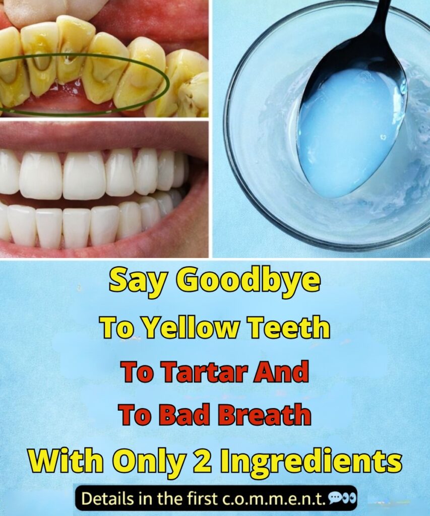 Say Goodbye to Yellow Teeth, Tartar Buildup, and Bad Breath Naturally