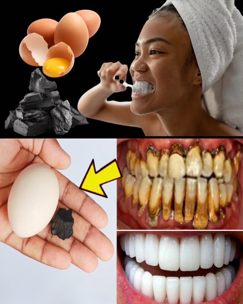 This Recipe for Teeth Whitening is the Fastest: Brush for Just 3 Minutes