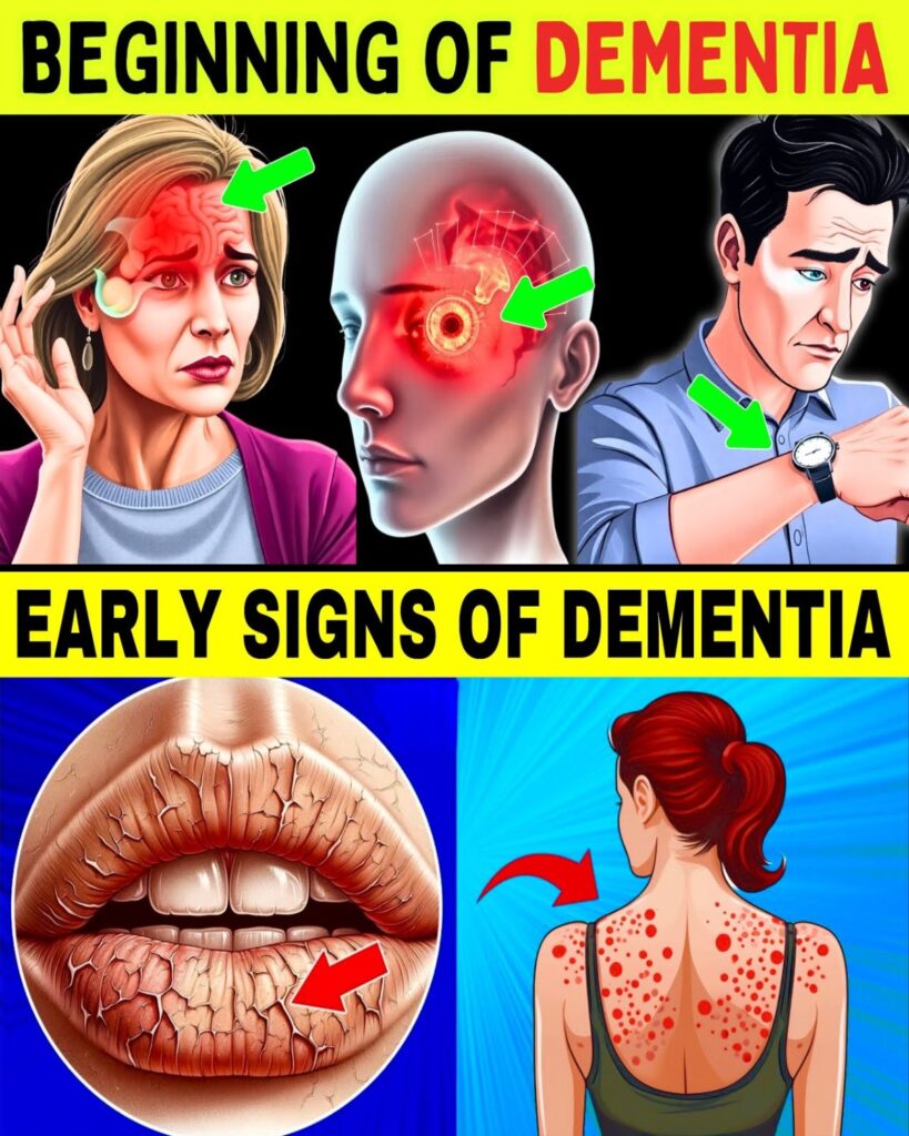 Over 60? 10 Early Dementia Warning Signs You Must NEVER Ignore (Catch Them Before It’s Too Late)