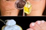 Say Goodbye to Stubborn Nail Fungus: This Simple 3-Ingredient Mix May Help Clear It Naturally