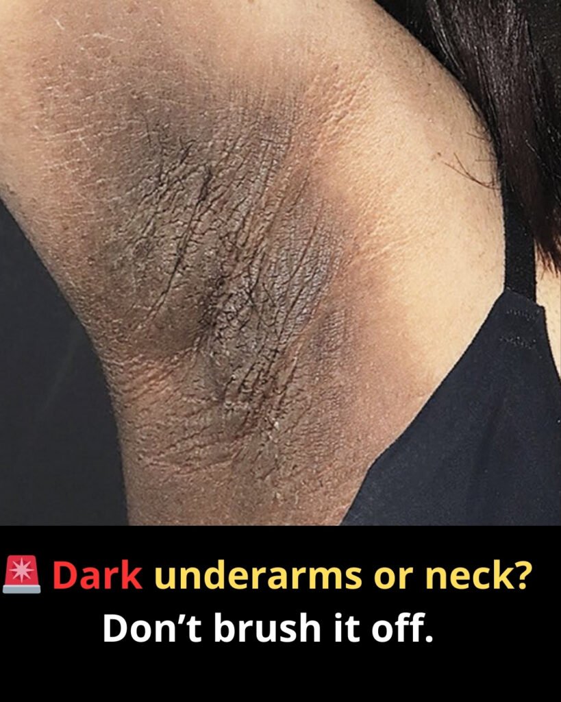 🚨 Dark underarms or neck? Don’t brush it off.