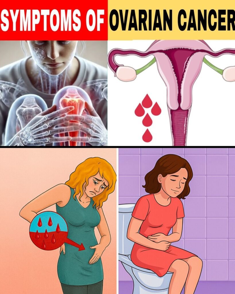 6 WARNING SYMPTOMS Of Ovarian Cancer