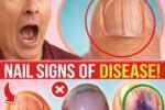Nail Ridges: The Silent Health Warnings Your Nails Are Sending (And What They Really Mean)