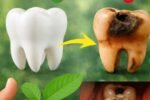 Did You Know 92% of Americans Over 50 Have At Least One Cavity Right Now—While This One Backyard Leaf Is Quietly Reversing Decay Without a Single Drill?