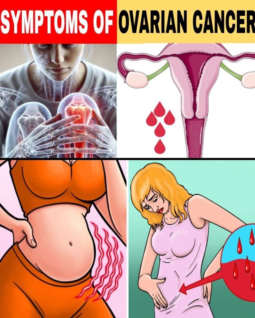 6 WARNING SYMPTOMS Of Ovarian Cancer