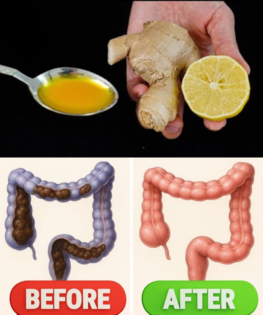 The Miracle Drink That Flushes Out 15kg of Toxins from Your Gut and Blood Vessels – Time-Tested Formula