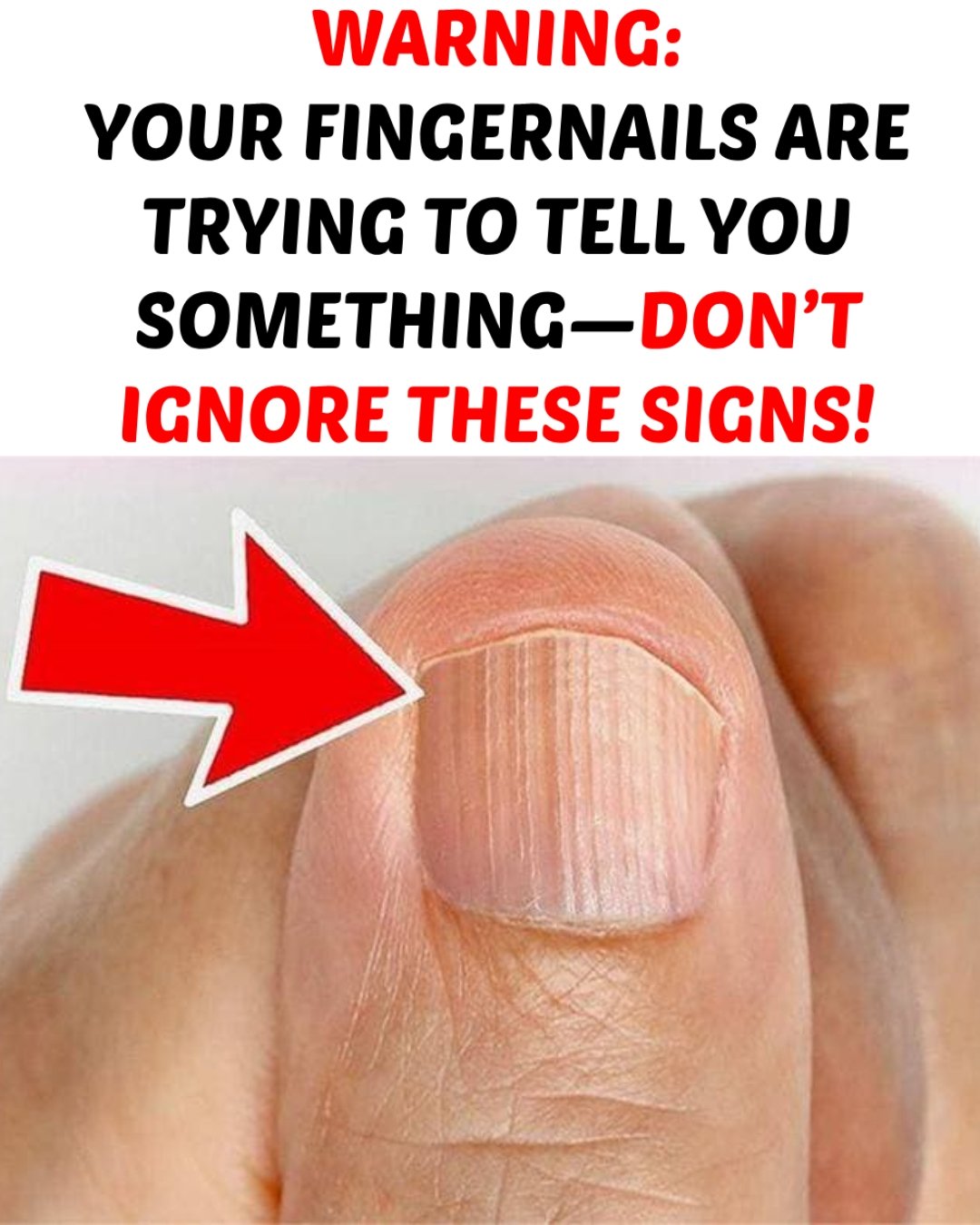 11 Health Warnings Your Fingernails May Be Sending