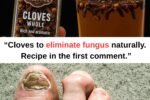 Nail Fungus Remedy That Works Like an Eraser – 100% Natural & Effective!