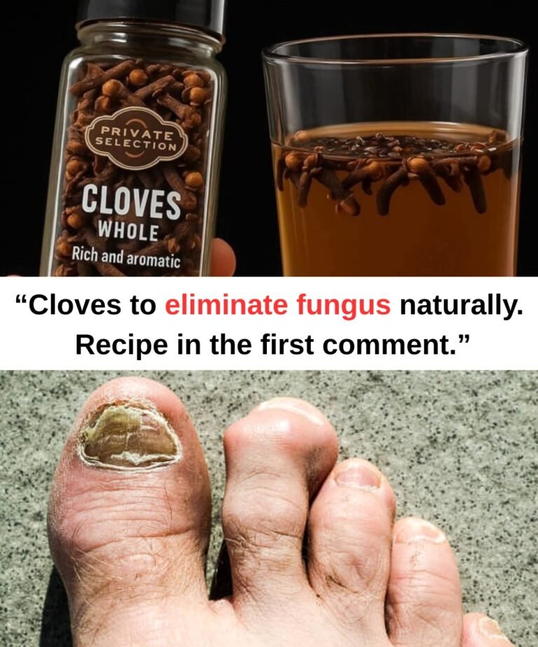 Nail Fungus Remedy That Works Like an Eraser – 100% Natural & Effective!