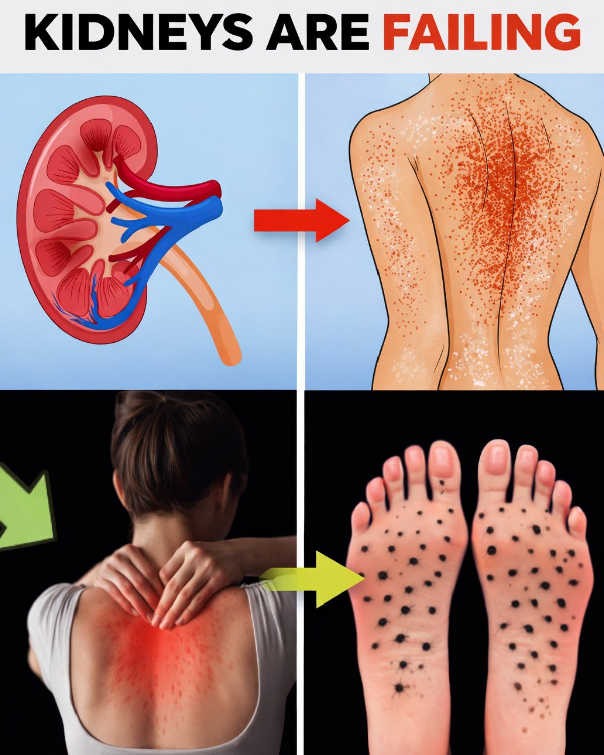 15 Signs of Kidney Failure: From Early Warnings to Late-Stage Symptoms (And What to Do NOW)