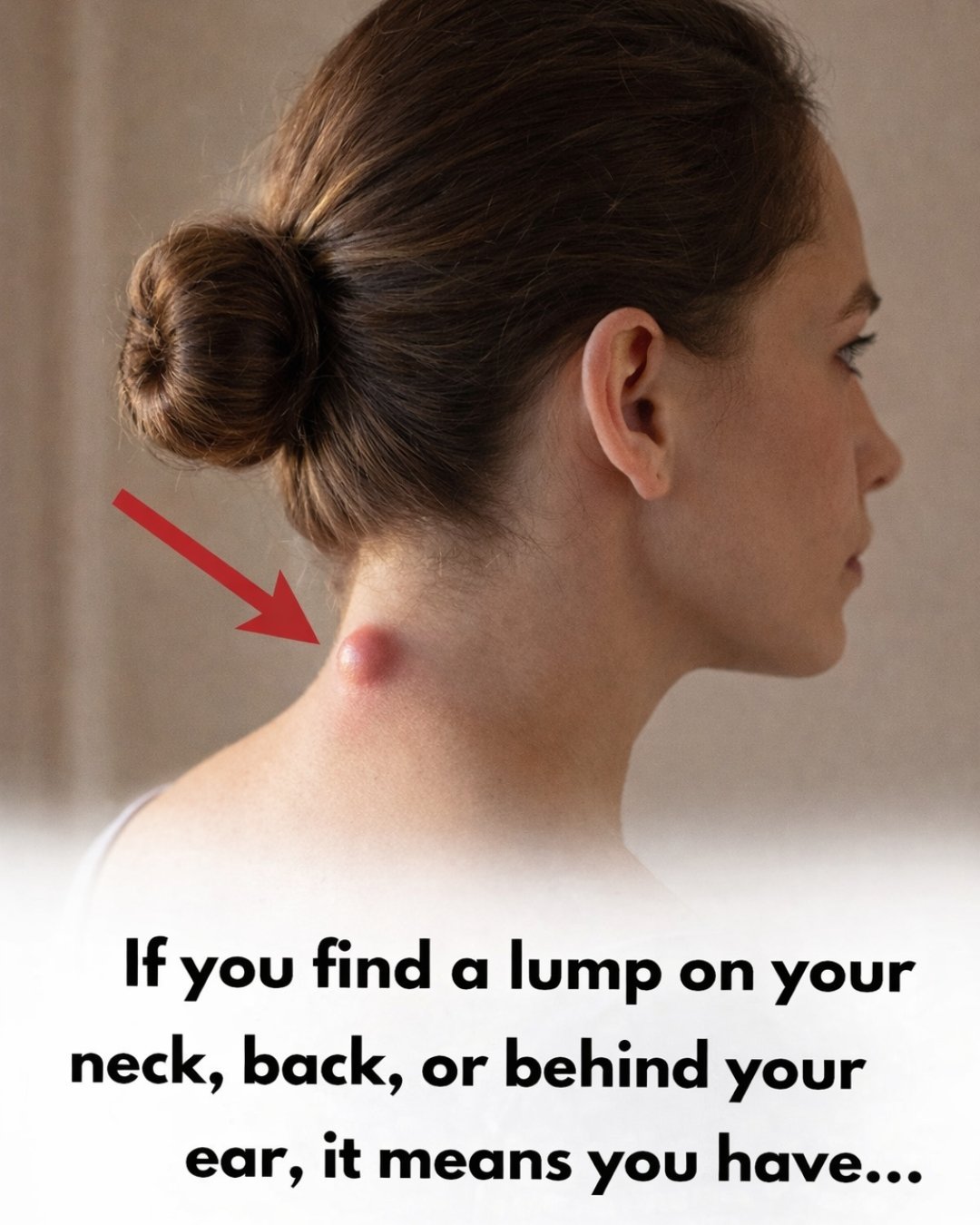 Lumps and Cysts: Signs, Causes, and Essential Care for Your Health