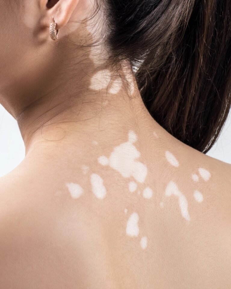 Many People Call This Eczema — But It’s NOT (And That’s Why It Keeps Coming Back)