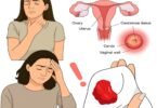Cervical Cancer: Early Signs and Symptoms You Should Never Ignore