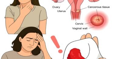 Cervical Cancer: Early Signs and Symptoms You Should Never Ignore
