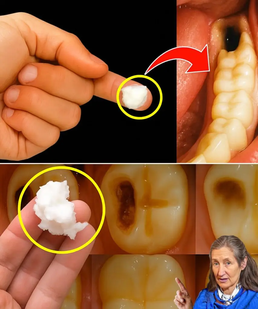 Simple Natural Tips to Keep Your Teeth Healthy – Avoid Extra Dental Visits with These 5 Natural Cavity Remedies