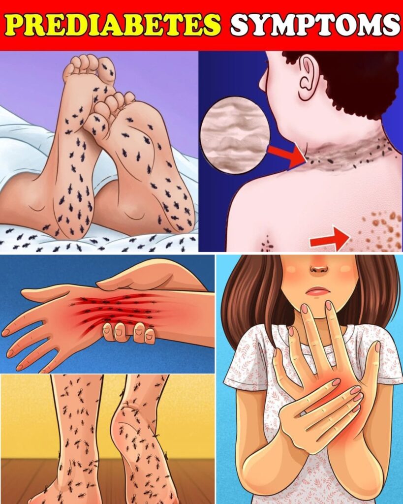 Don’t Ignore These: 12 Prediabetes Warning Signs and What Can Help