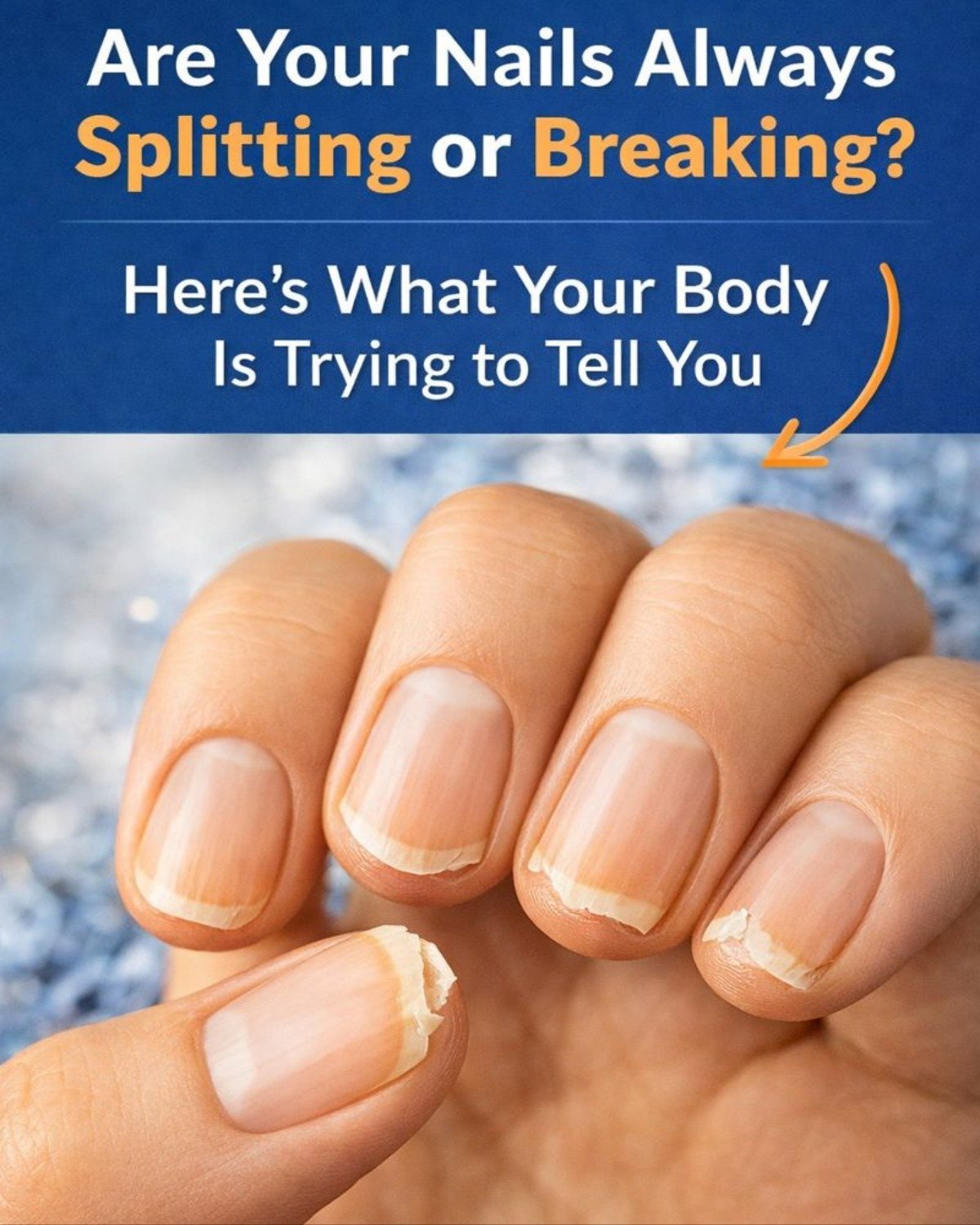 Why Your Nails Keep Splitting: The Hidden Health Signals You Can’t Ignore