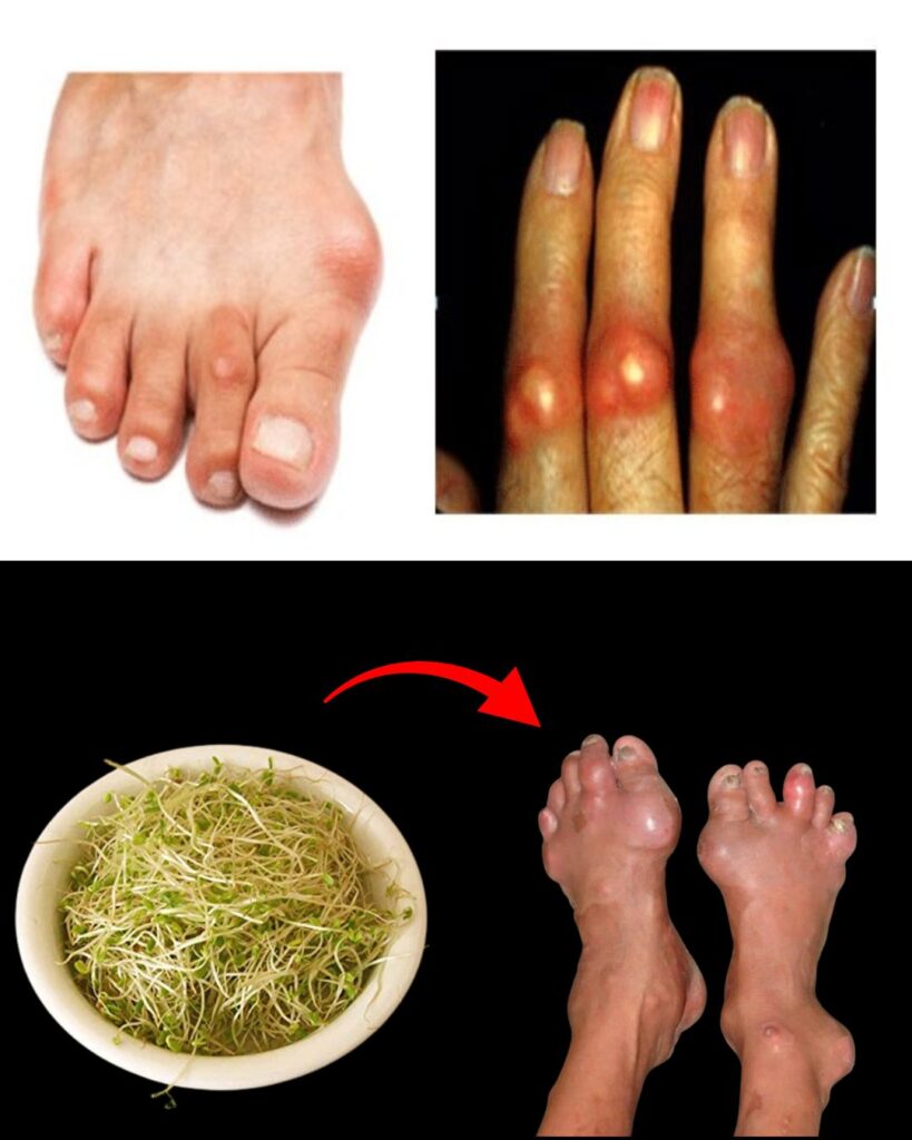 Alfalfa for Kidney Support