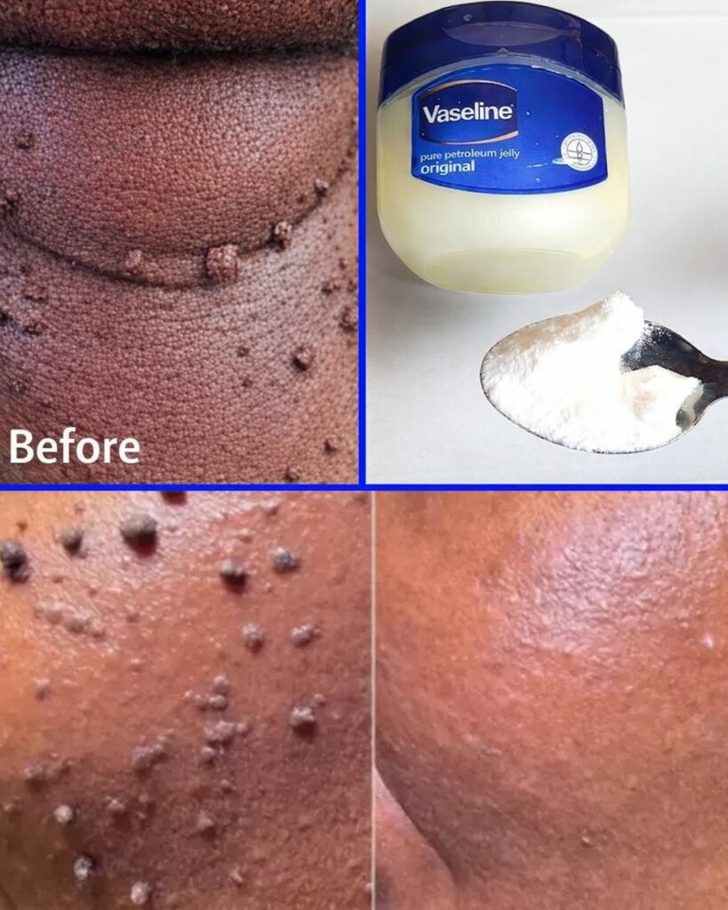 Those Stubborn Little White Bumps: Understanding Milia and Safe Ways to Improve Your Skin’s Appearance