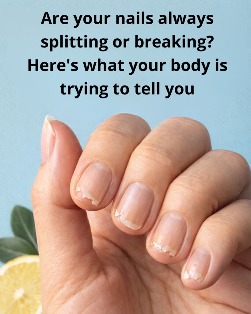 Why Are My Nails Splitting and Brittle? 9 Surprising Reasons Your Body Is Trying to Tell You Something