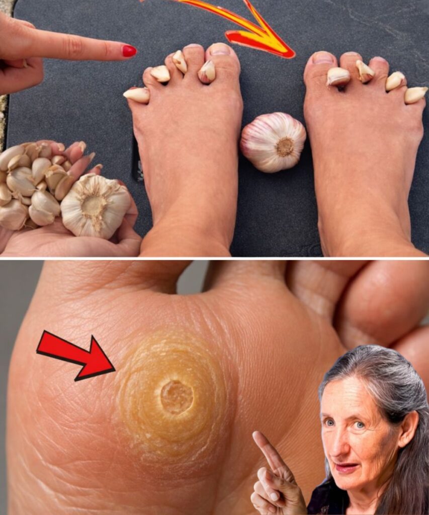 9 Surprising Ways Garlic Can Naturally Support Healthier Feet at Home