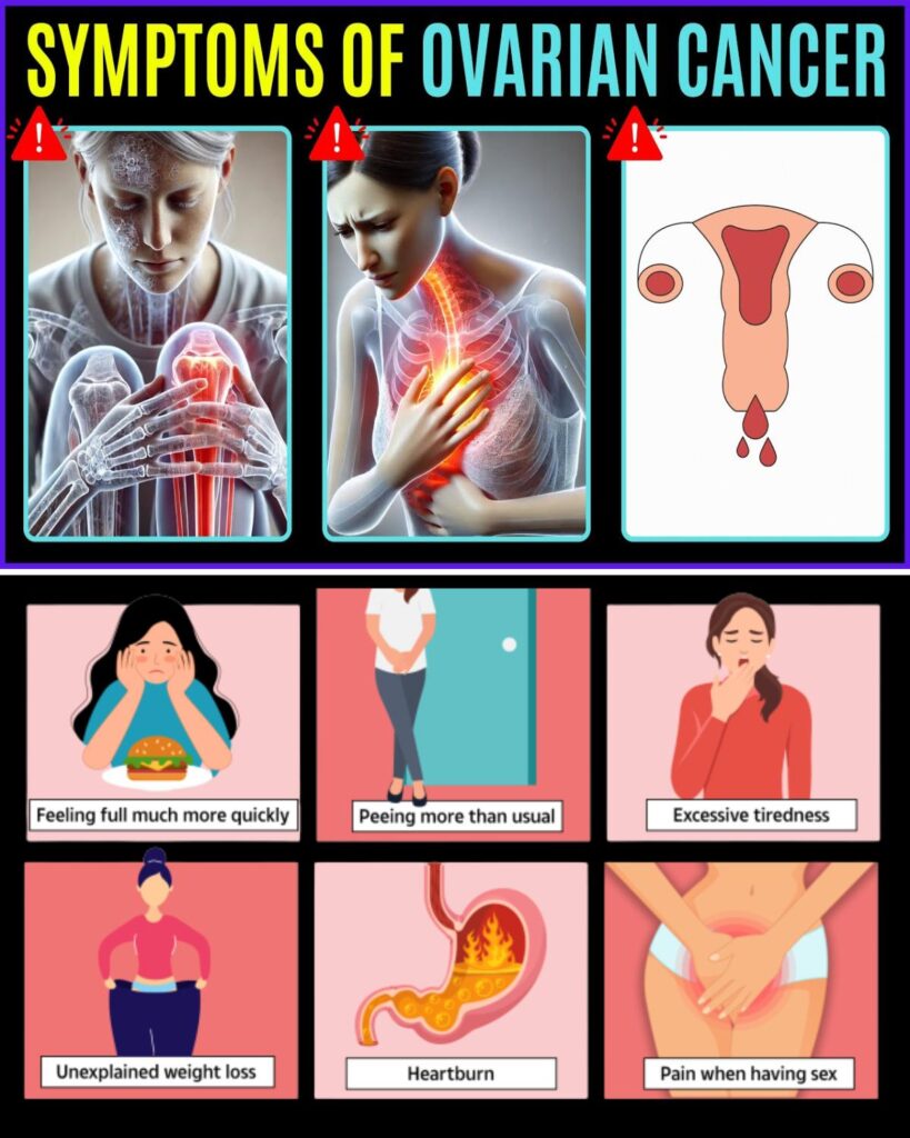 Risk! 12 WARNING Symptoms of Ovarian Cancer (Doctors Never Say) | Ovarian Cancer Symptoms