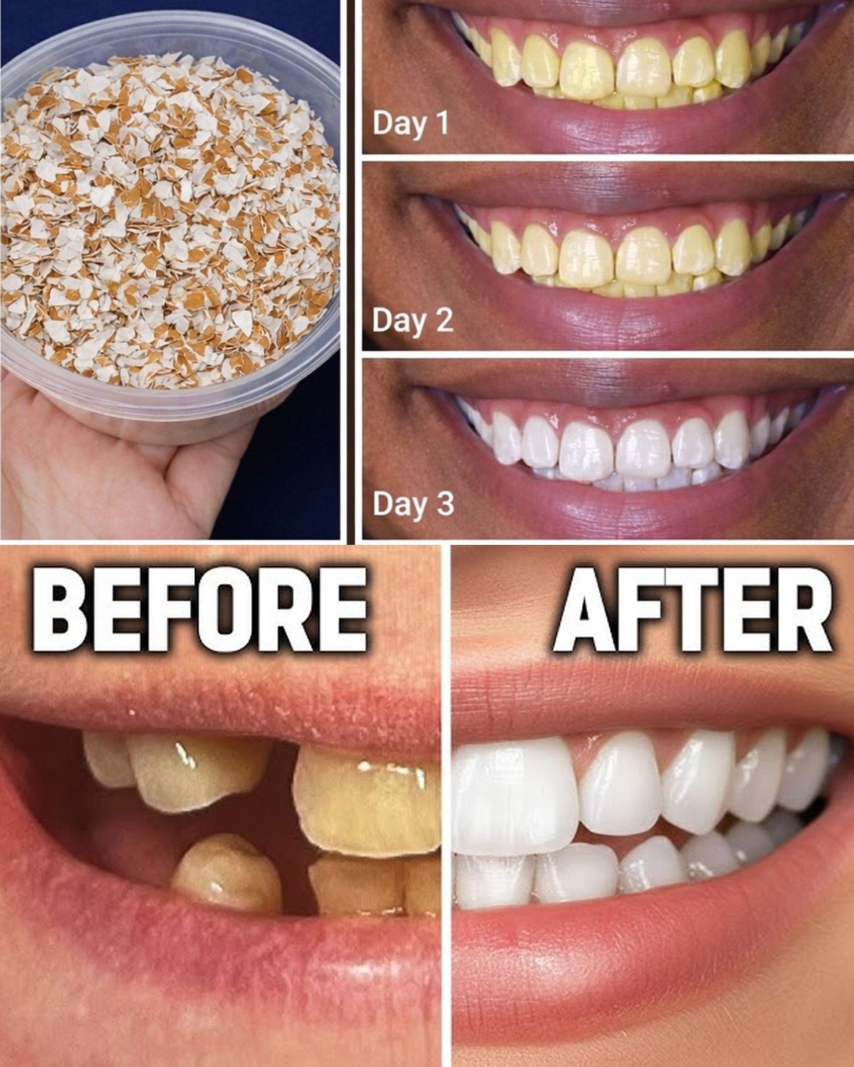 Eggshells Transform Yellow Teeth to Pearl White in Just 5 Minutes