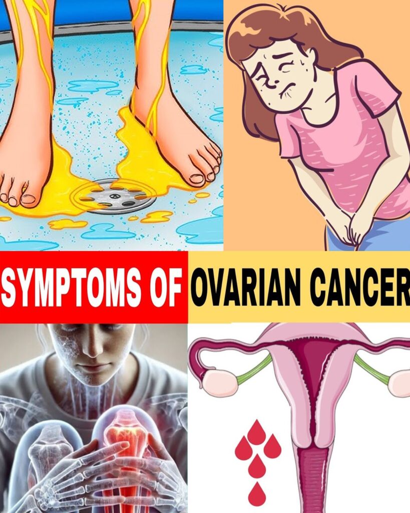 6 Subtle Warning Signs of Ovarian Cancer That Most Women Overlook