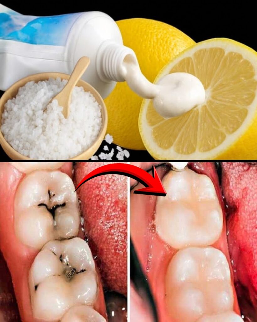 Can You Naturally Repair a Cavity? The Truth About Remineralization (And When It’s Time to See a Dentist)