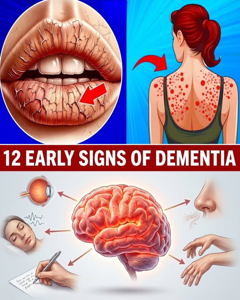 12 Subtle Early Warning Signs of Dementia Your Brain Is Sending Years in Advance