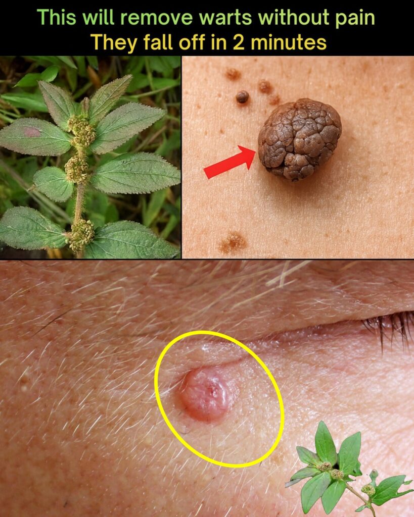 7 Natural Approaches That May Support Wart Management and Skin Comfort