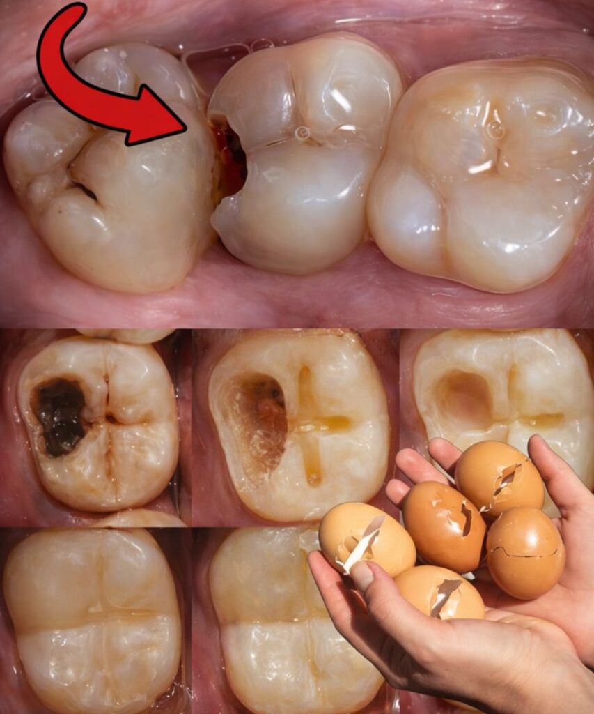 Discover the Gentle Natural Secret to Brighter Teeth with Eggshells