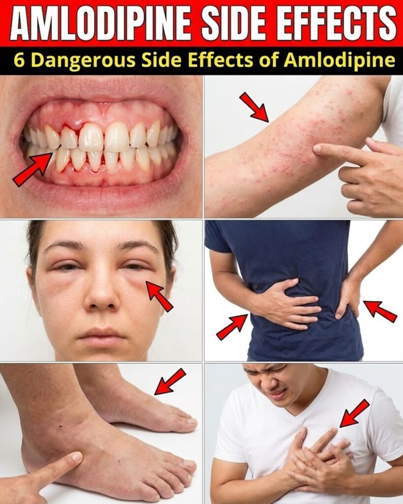 Amlodipine Side Effects Decoded: What Your Body Is Telling You