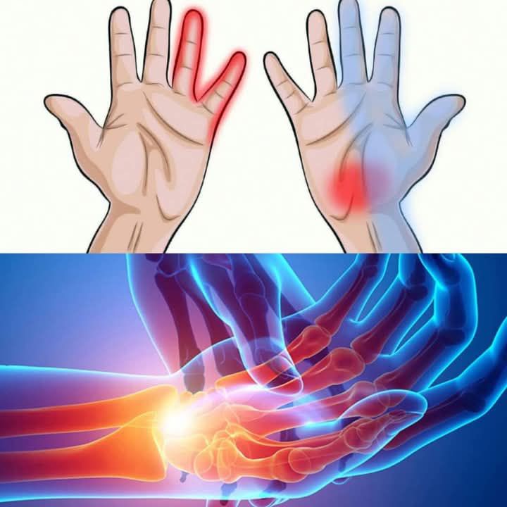 “7 Things Your Hands Can Tell You About Your Health”