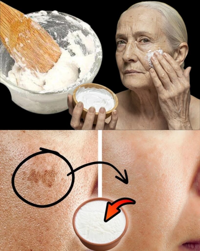 Could Baking Soda Help Fade Age Spots? A Natural Approach Women Over 50 Are Exploring