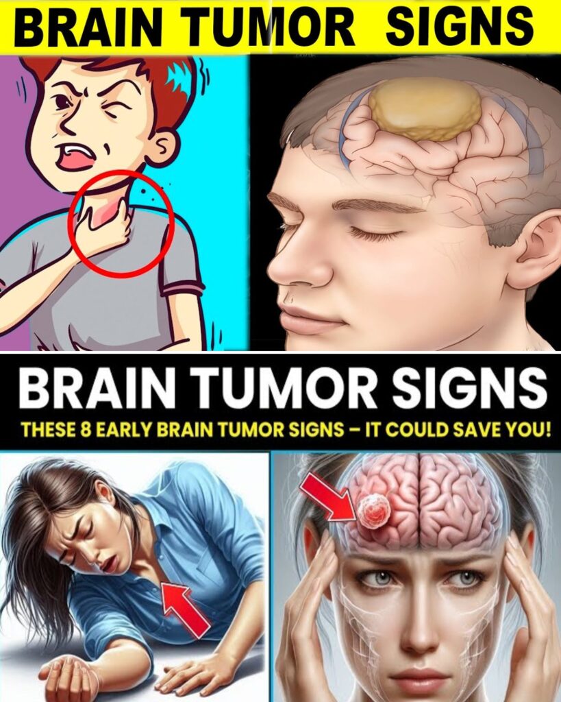 Don’t Miss These 8 Early Brain Tumor Signs – It Could Save You!