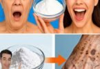 Is Baking Soda the Fastest Way to Fade Dark Spots at Home? The Truth About This Viral Remedy