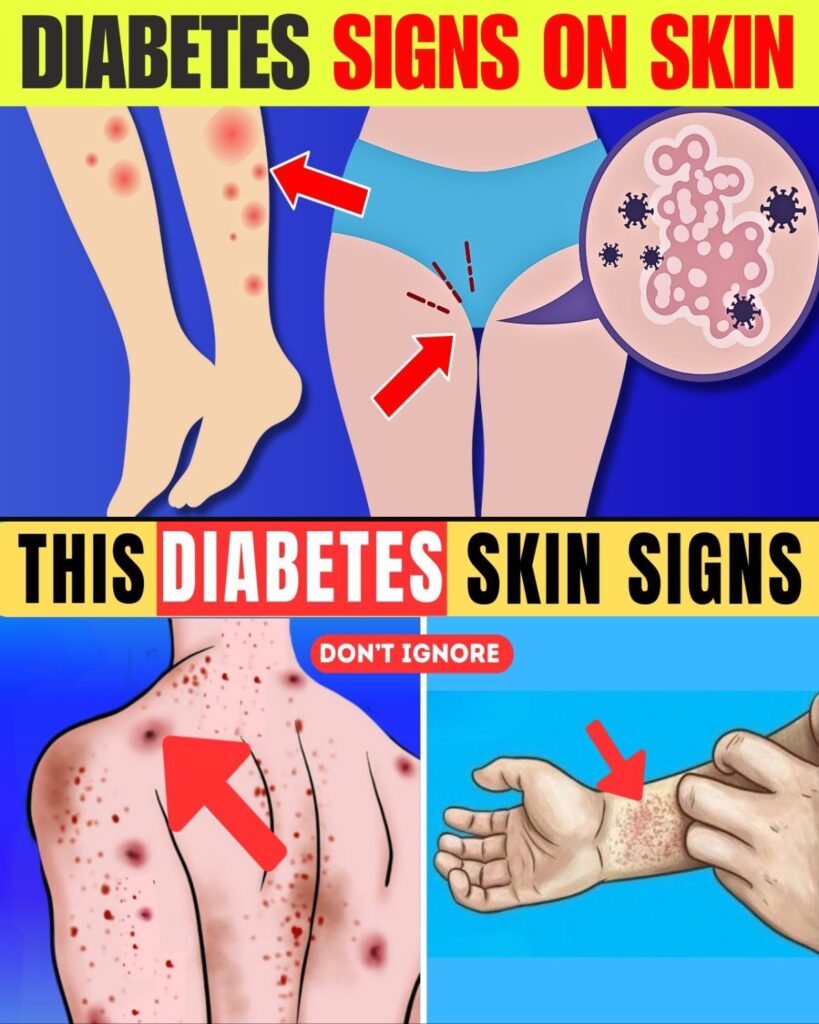 8 Diabetes Signs on Skin | Beware – These Could Be Early Warnings