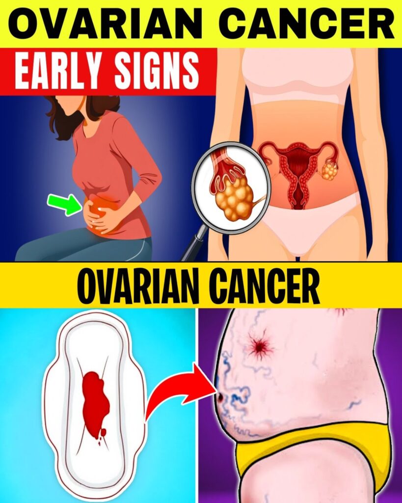 8 Signs of Ovarian Cancer Every Woman Should Watch For – Knowledge That Could Make a Difference