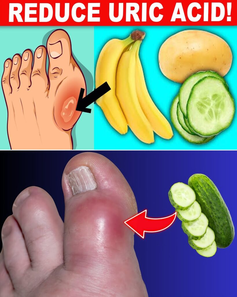 11 Foods That Naturally Help Lower Your Uric Acid Levels – Backed by Research