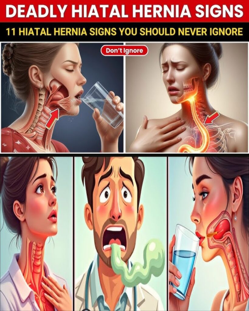 10 Hiatal Hernia Signs and Symptoms You Should Know!