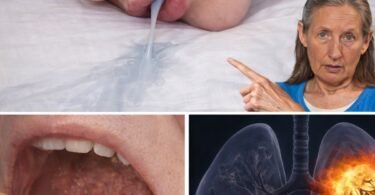 If You Drool While Sleeping, These 8 Conditions Might Be Worth Checking Out