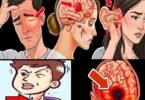 Don’t Miss These 8 Early Warning Signs of a Brain Tumor – Recognizing Them Could Save Your Life