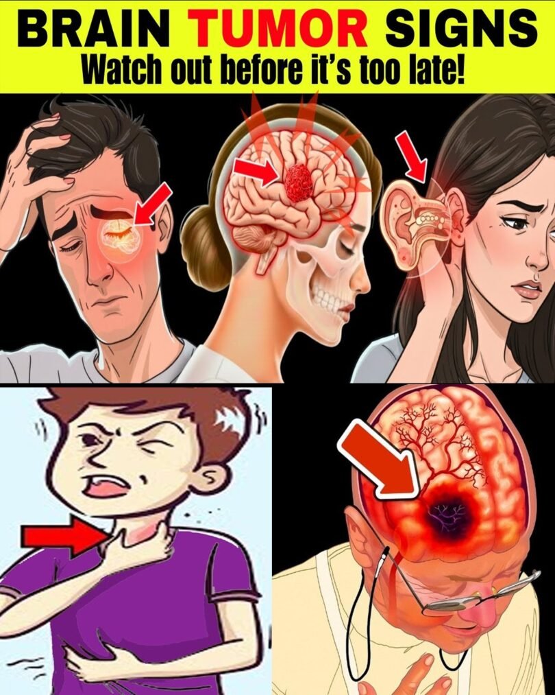 Don’t Miss These 8 Early Warning Signs of a Brain Tumor – Recognizing Them Could Save Your Life