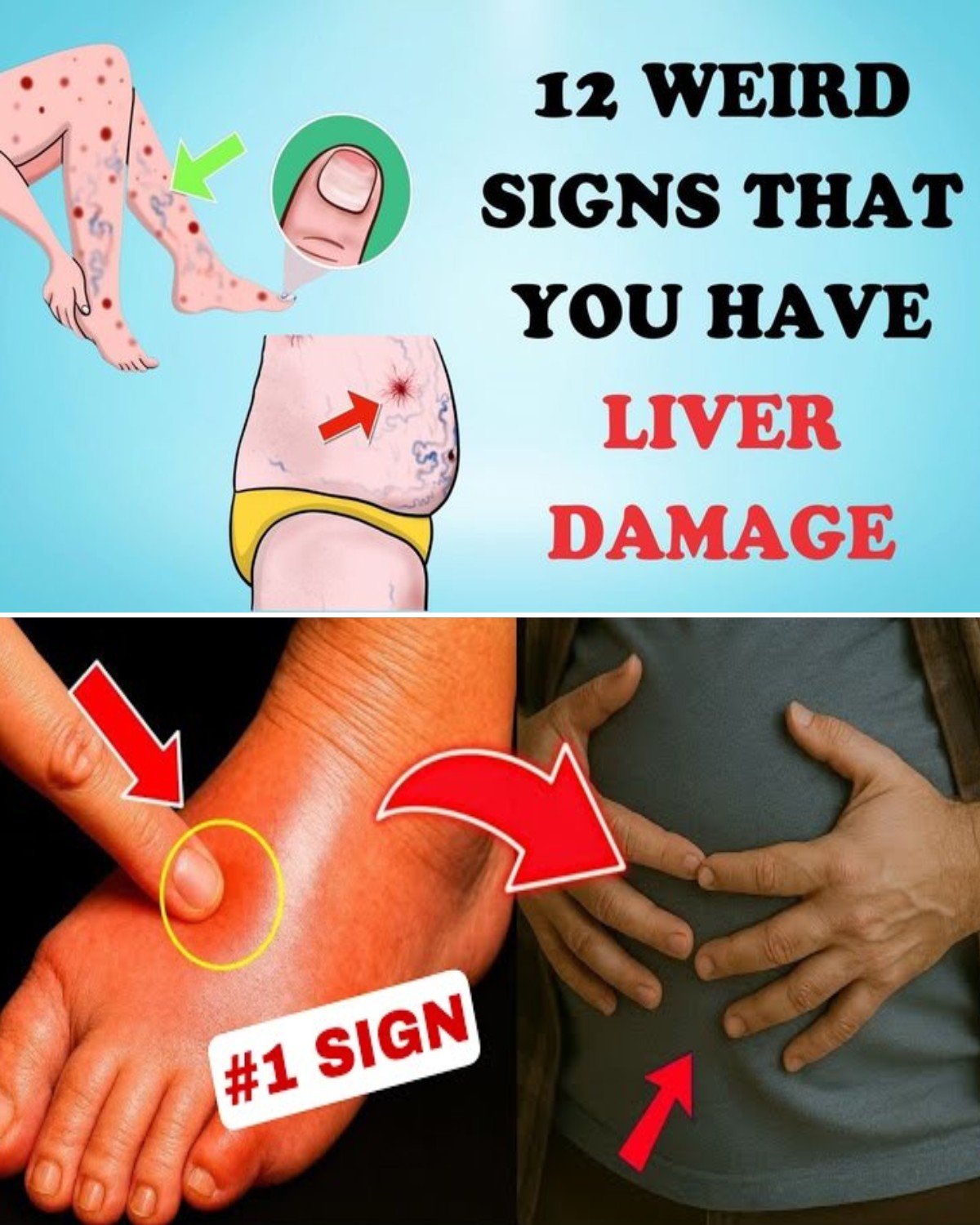 Warning: 12 Weird Signs That Show You’re Having Liver Damage