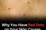 Why You Have Red Dots on Your Skin: Causes, Meanings, and Natural Relief
