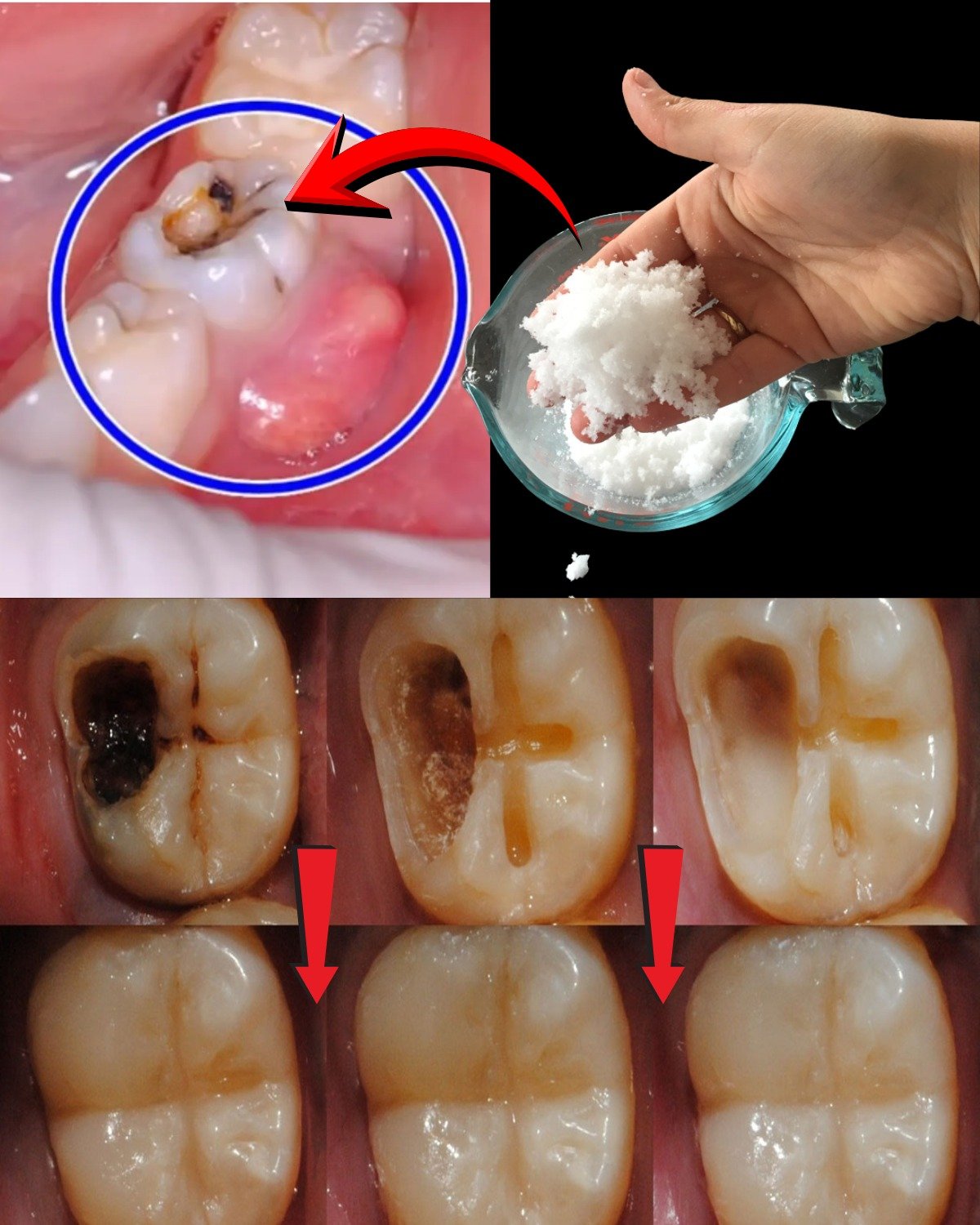 Keep These Tips in Mind to Avoid Visiting the Dentist: How to Naturally Support Early Cavity Repair